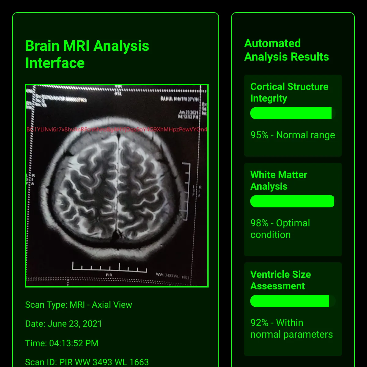 the project is loading